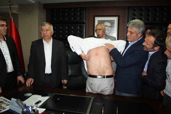 organ-bicakcioglu-besikduzu-belediye-baskani-makaminda-darp-edildi-(1).jpg