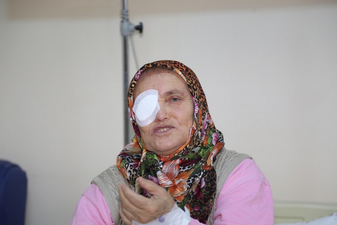 rizede-ilk-kez-kornea-nakli-yapildi-(3).jpg