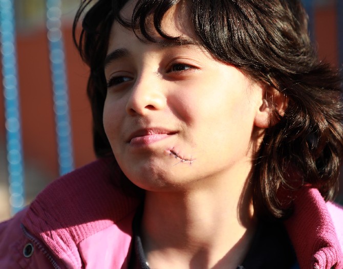 rizede-sokak-kopeginin-saldirisina-ugrayan-cocuk-yuzunden-yaralandi-4.jpg